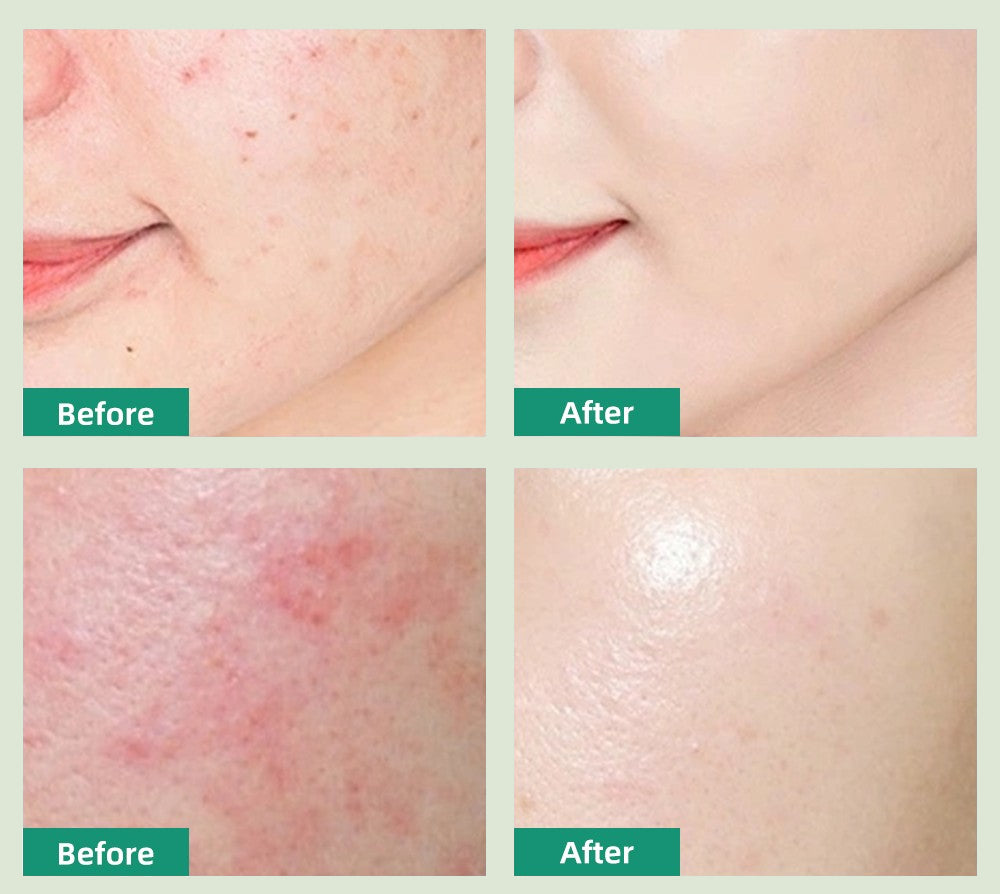 Madagascar Centella Revitalizing Face Cream