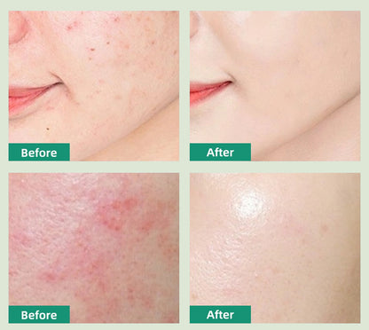 Madagascar Centella Face Cream